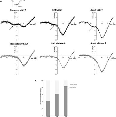 Calcium Channels in Postnatal Development of Rat Pancreatic Beta Cells and Their Role in Insulin Secretion